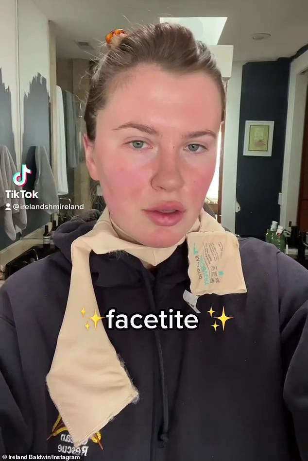 Honesto: Ireland Baldwin fala sobre por que ela está passando por FaceTite, um procedimento cosmético minimamente invasivo comparável a um lifting cirúrgico, este mês
