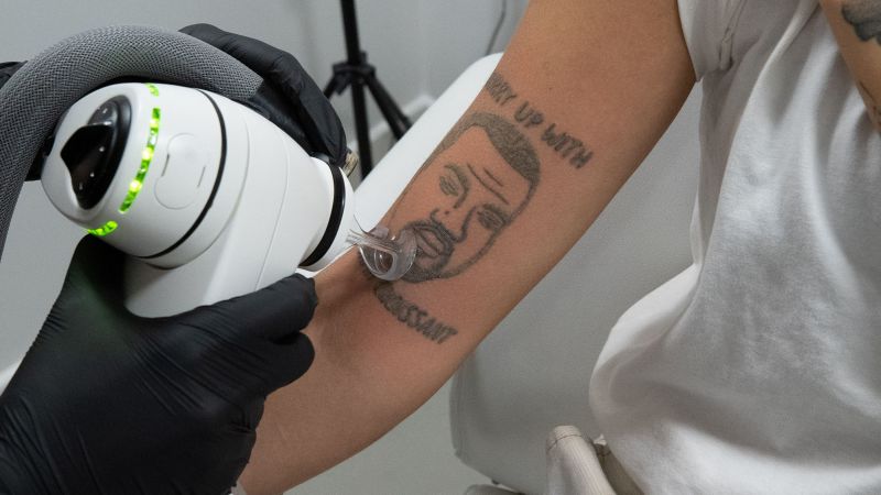Este estúdio de remoção de tatuagens em Londres ainda removerá as tatuagens de Kanye West gratuitamente